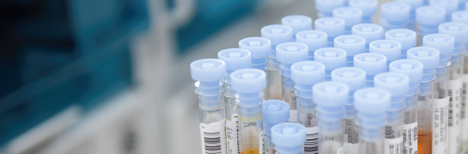 Rack with many test tubes ready for analysis.